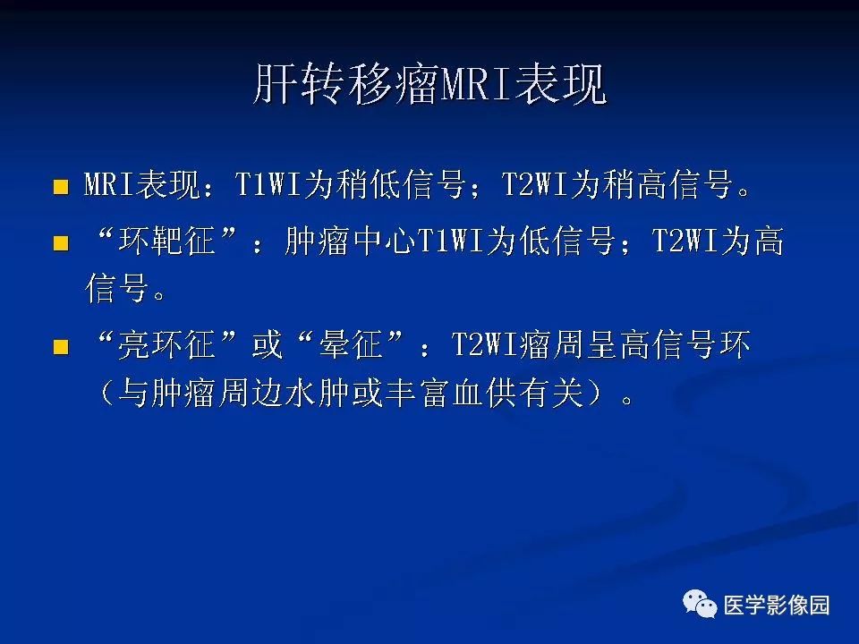【PPT】肝脏转移瘤的影像学诊断