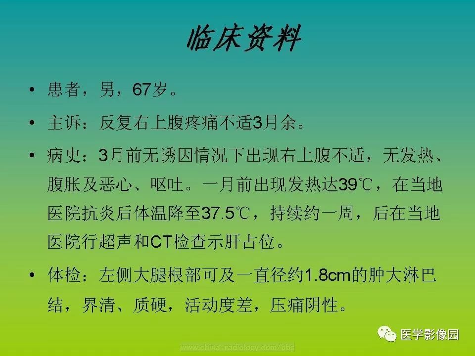 【病例】肝脏转移性黑色素瘤1例CT影像表现