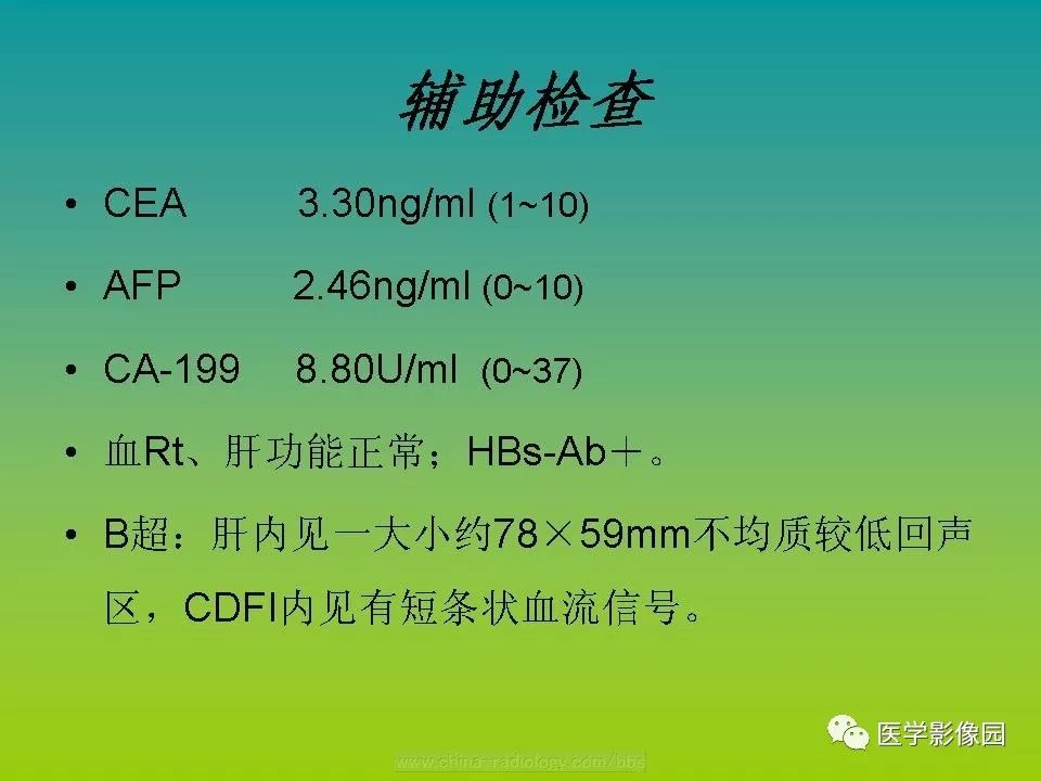 【病例】肝脏转移性黑色素瘤1例CT影像表现
