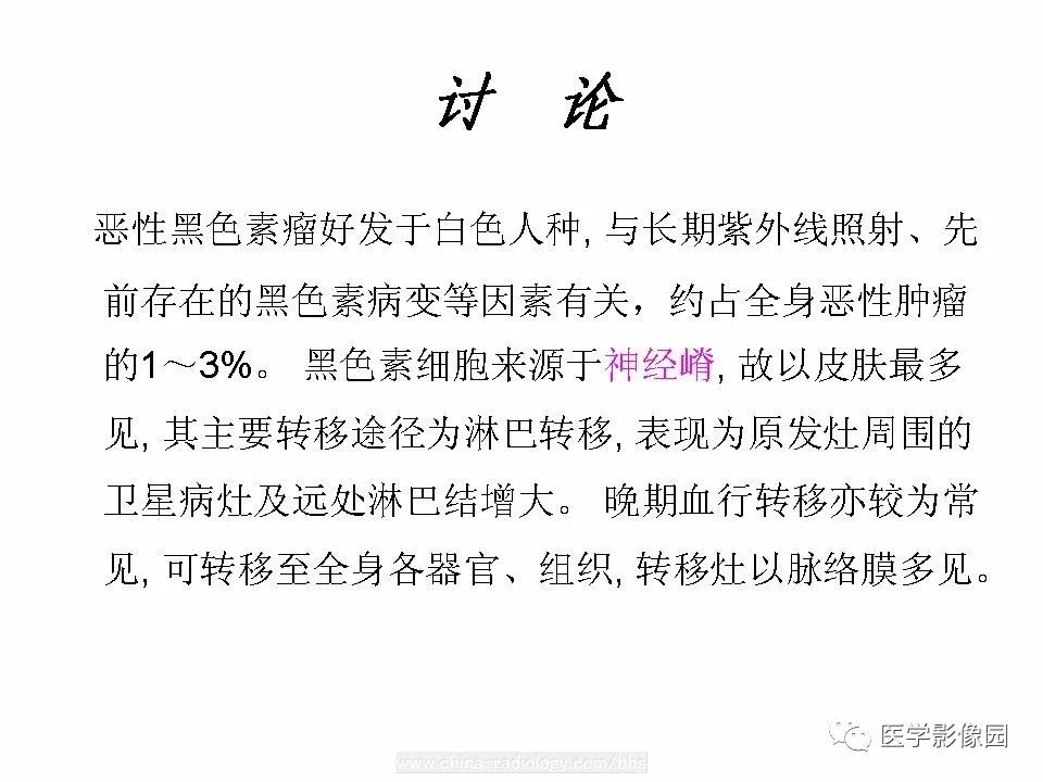 【病例】肝脏转移性黑色素瘤1例CT影像表现