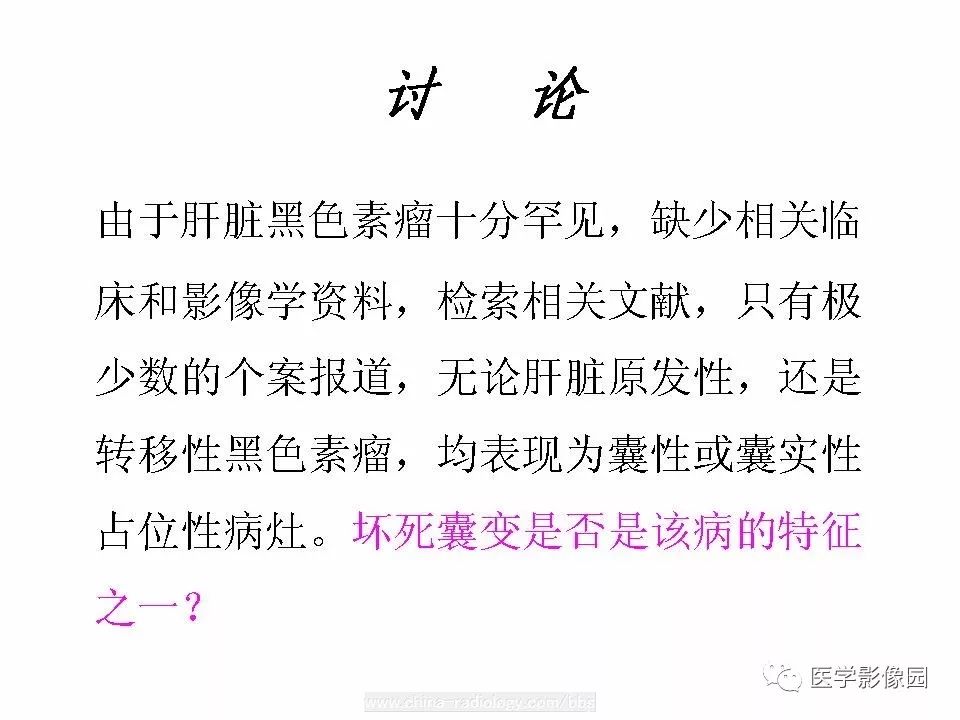 【病例】肝脏转移性黑色素瘤1例CT影像表现