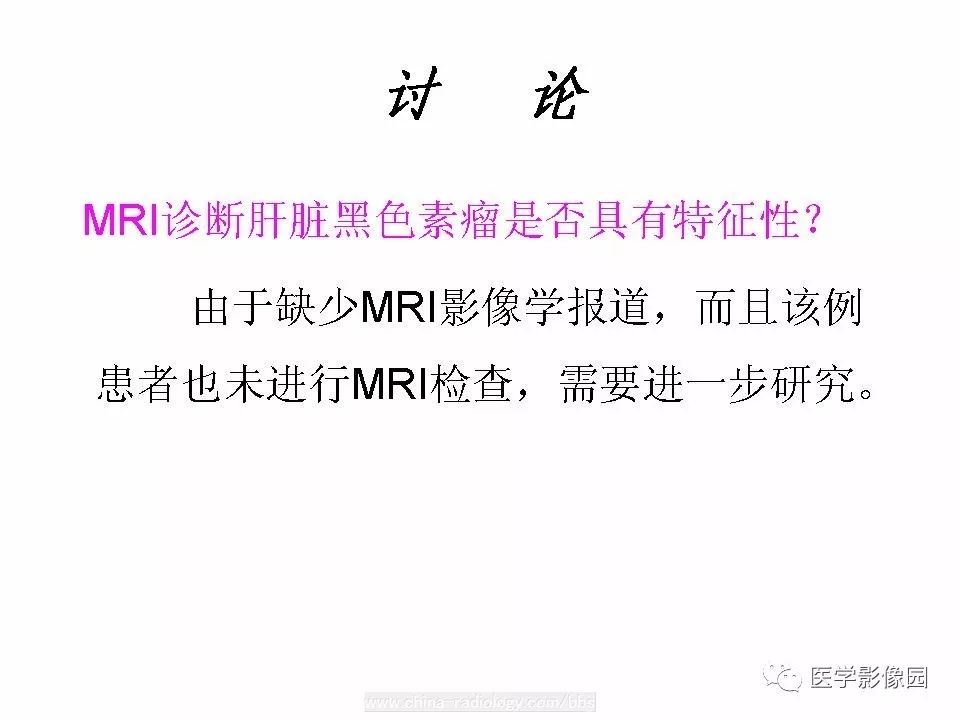 【病例】肝脏转移性黑色素瘤1例CT影像表现