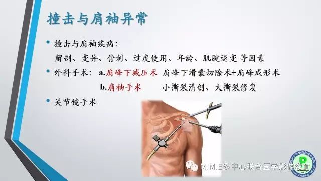【PPT】术后肩关节影像：肩袖、盂唇及二头肌腱