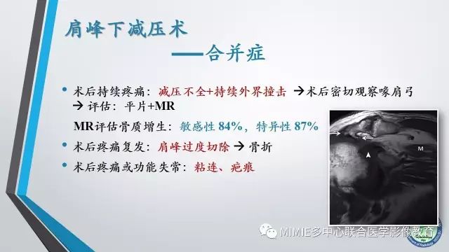 【PPT】术后肩关节影像：肩袖、盂唇及二头肌腱