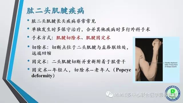 【PPT】术后肩关节影像：肩袖、盂唇及二头肌腱