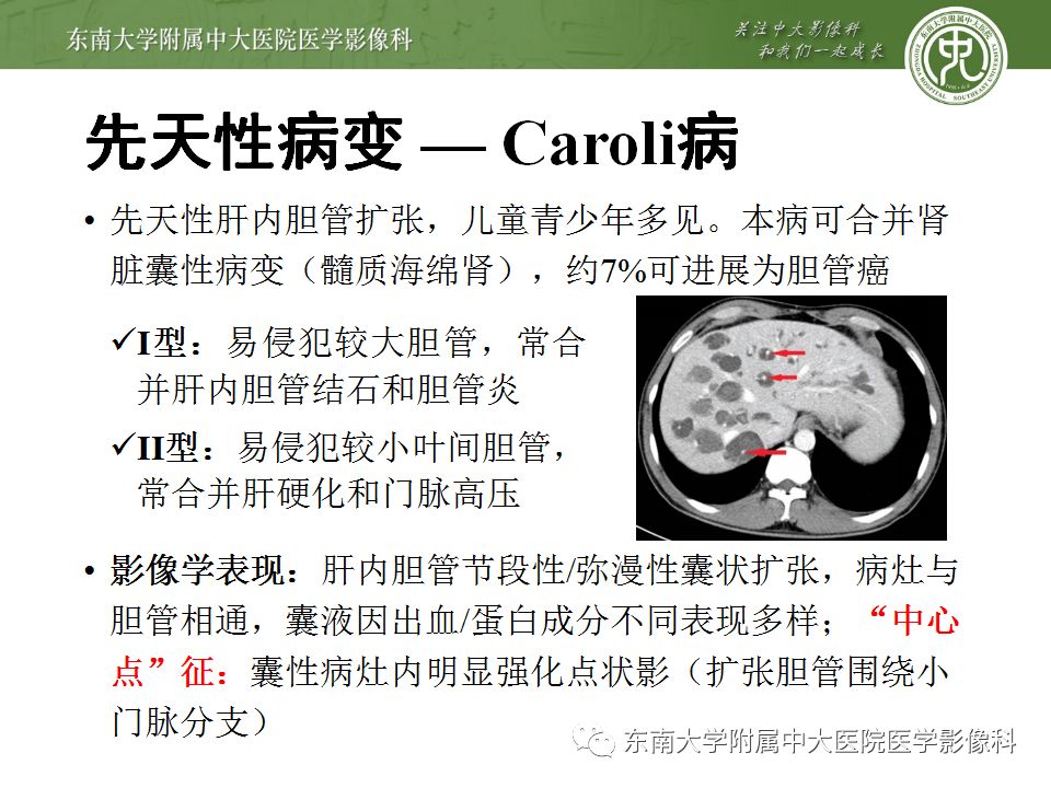 【病例】肝包虫囊肿VS胆管囊腺癌