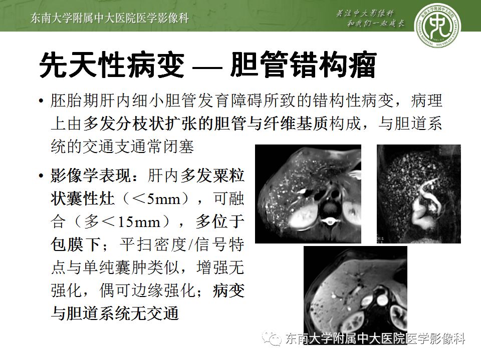 【病例】肝包虫囊肿VS胆管囊腺癌