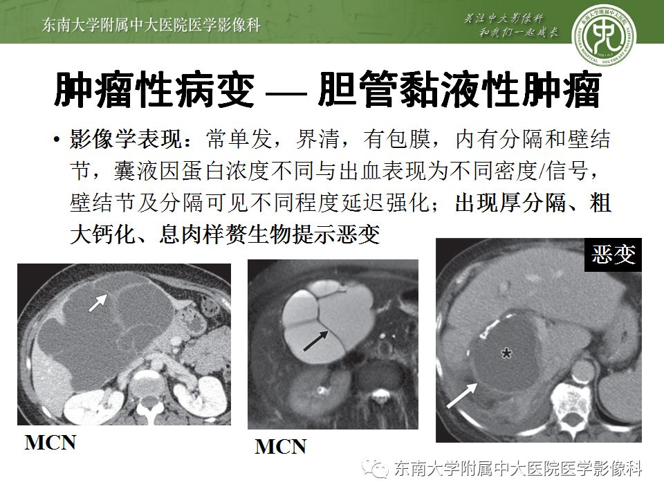 【病例】肝包虫囊肿VS胆管囊腺癌