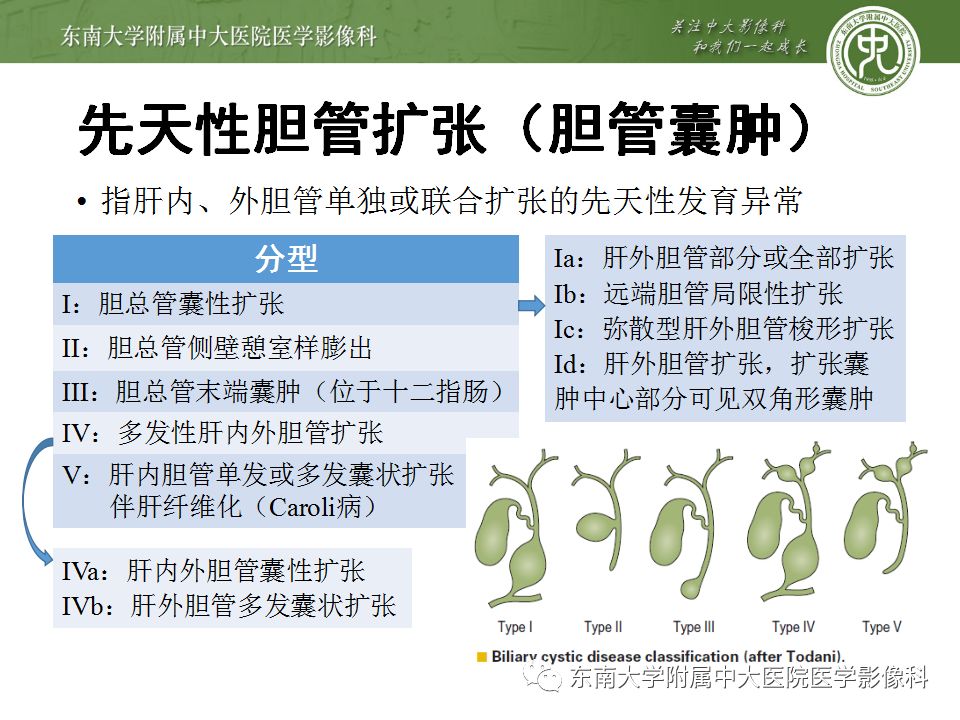【病例】Caroli病1例MR影像表现
