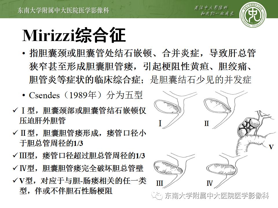 【病例】Caroli病1例MR影像表现