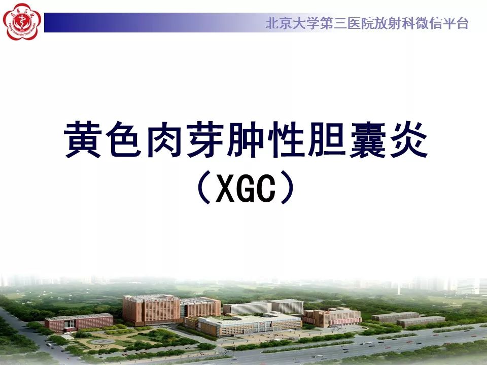【病例】黄色肉芽肿性胆囊炎1例CT及MR影像诊断