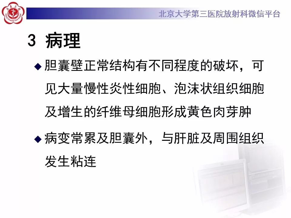 【病例】黄色肉芽肿性胆囊炎1例CT及MR影像诊断