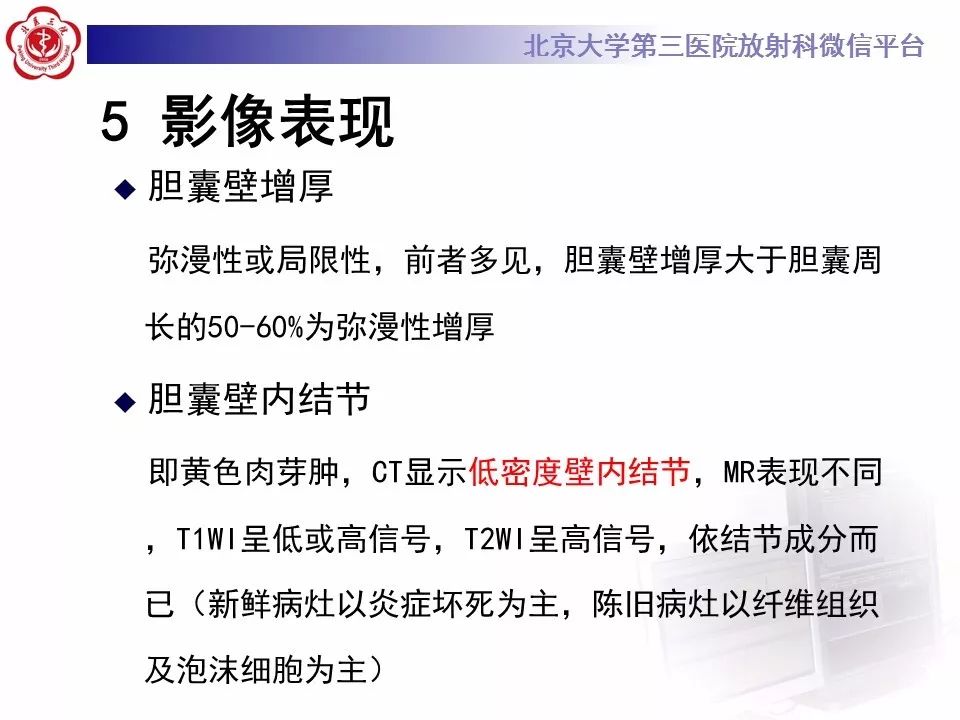 【病例】黄色肉芽肿性胆囊炎1例CT及MR影像诊断