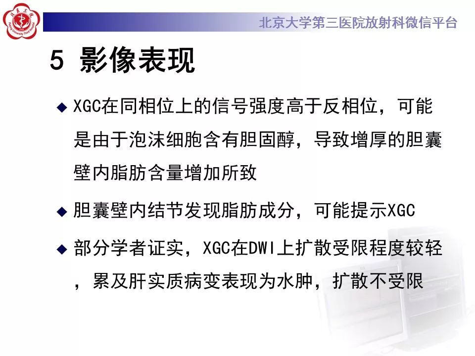 【病例】黄色肉芽肿性胆囊炎1例CT及MR影像诊断