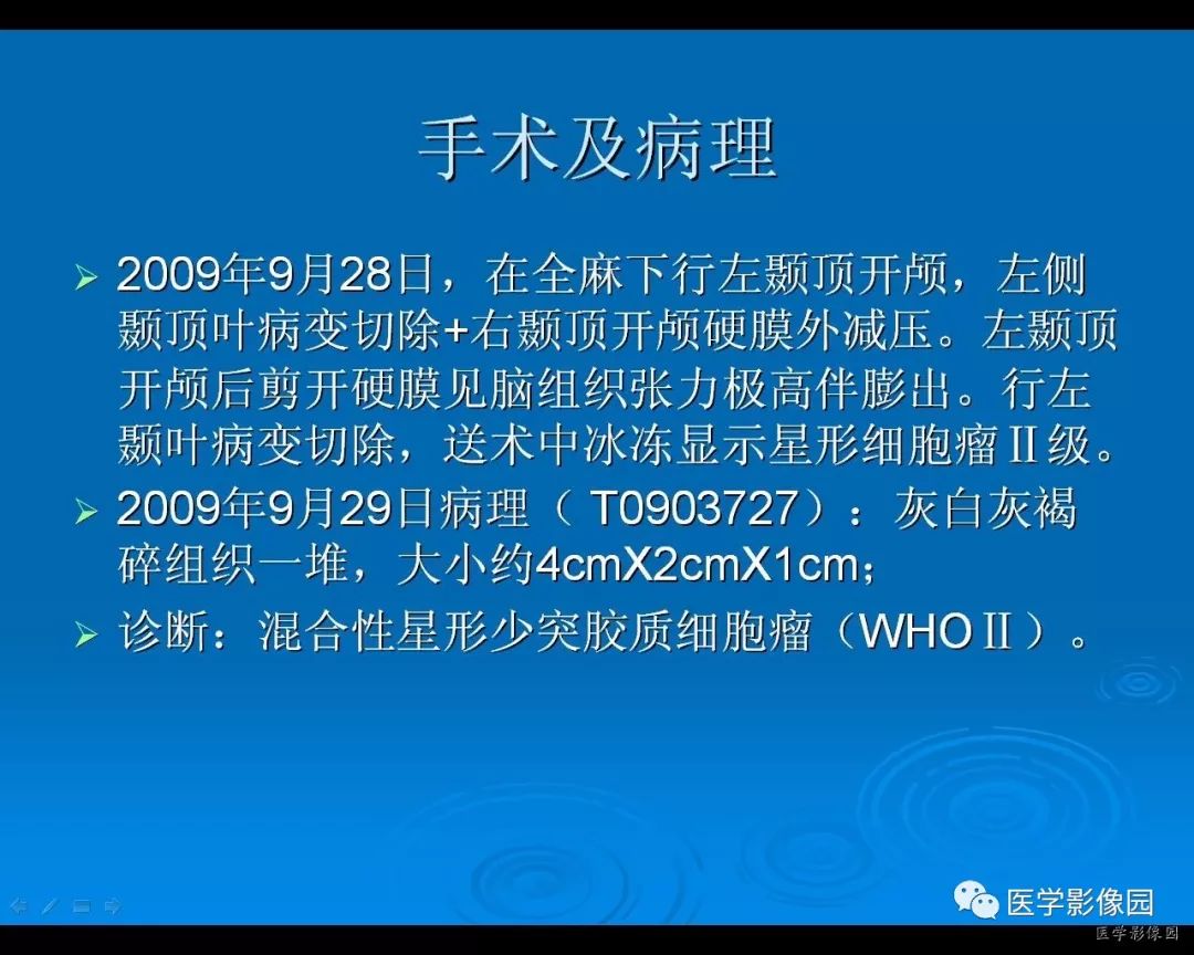 自动草稿