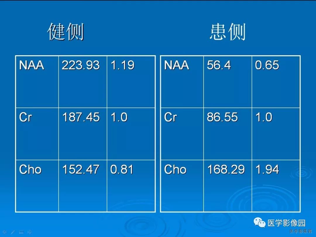 自动草稿