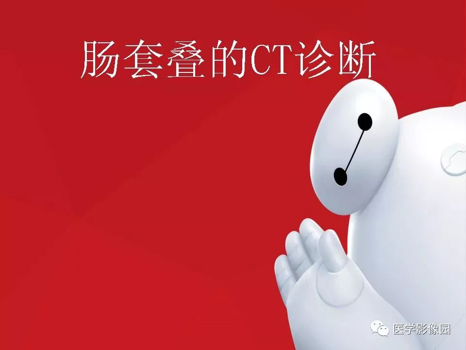 【PPT】肠套叠的CT诊断