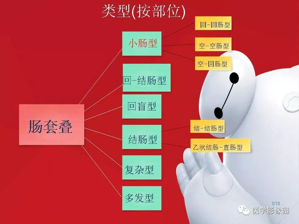 【PPT】肠套叠的CT诊断