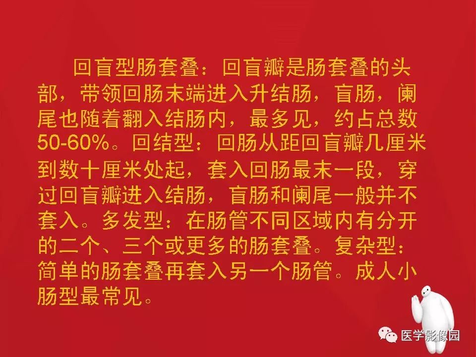 【PPT】肠套叠的CT诊断
