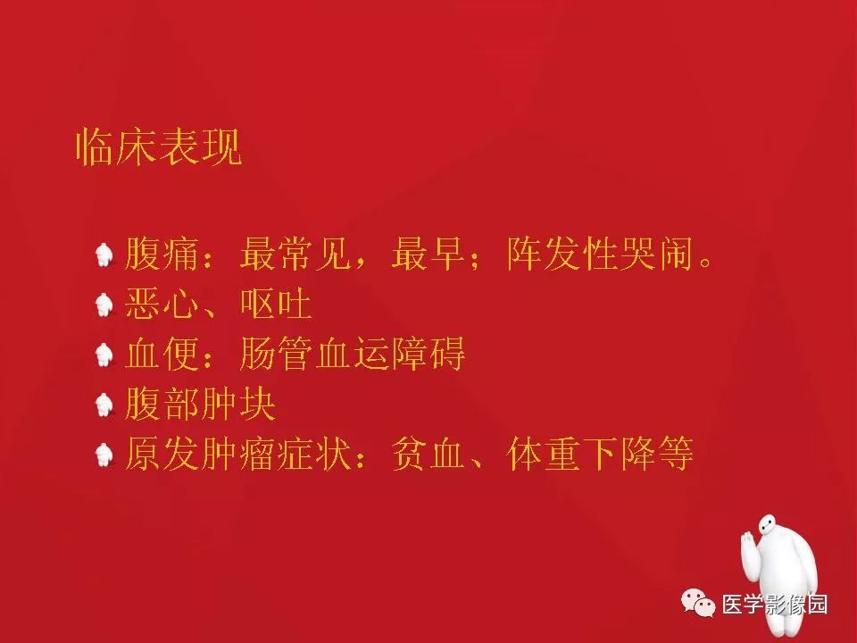 【PPT】肠套叠的CT诊断