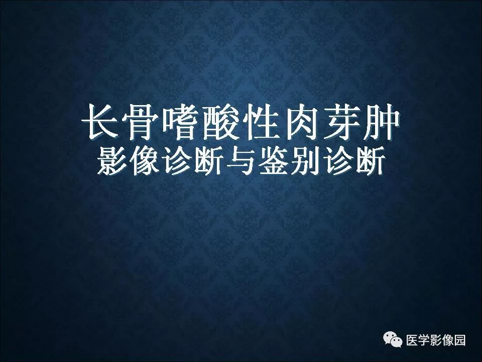 【PPT】长骨嗜酸性肉芽肿影像诊断与鉴别诊断