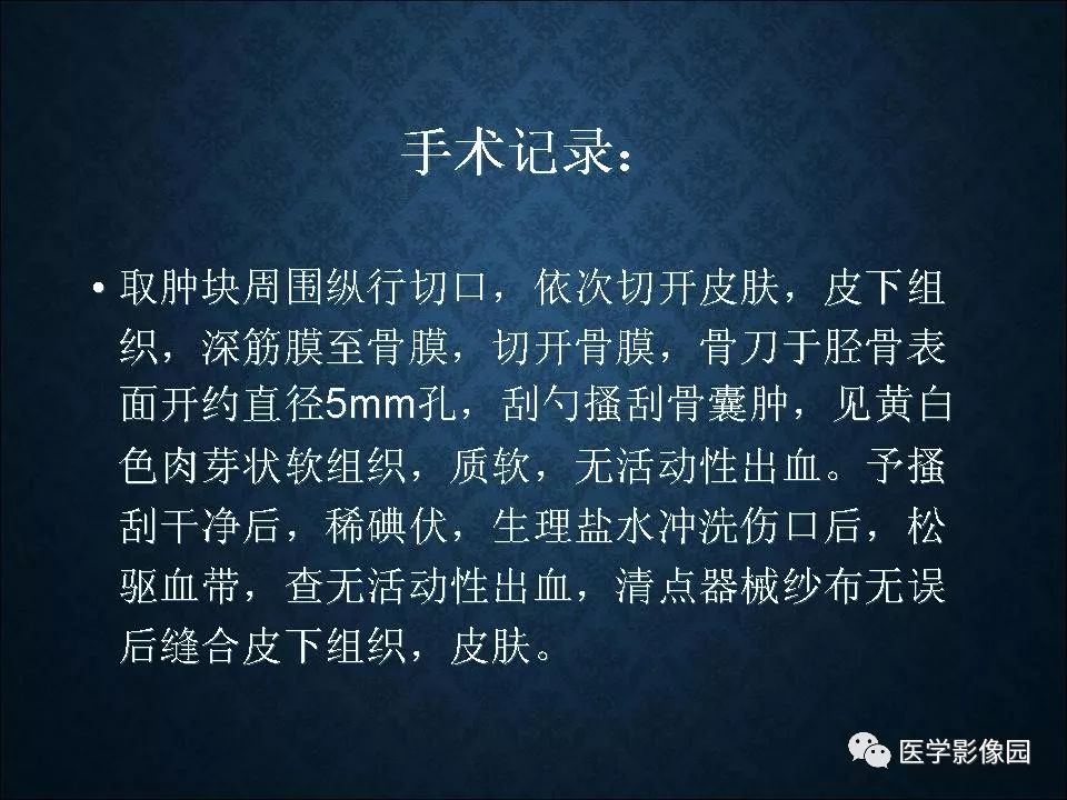 【PPT】长骨嗜酸性肉芽肿影像诊断与鉴别诊断