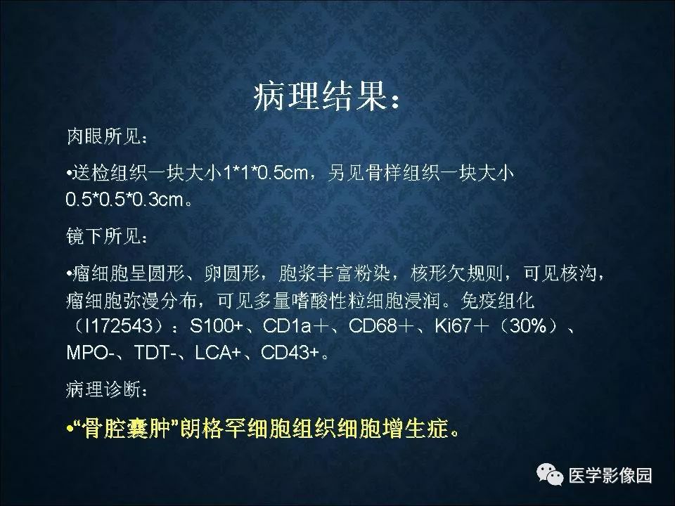 【PPT】长骨嗜酸性肉芽肿影像诊断与鉴别诊断