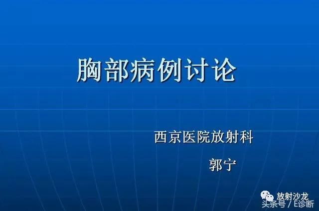 【病例】胸部孤立性纤维瘤1例CT影像表现