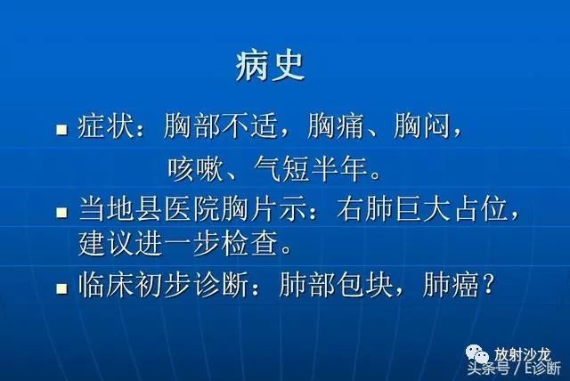 【病例】胸部孤立性纤维瘤1例CT影像表现