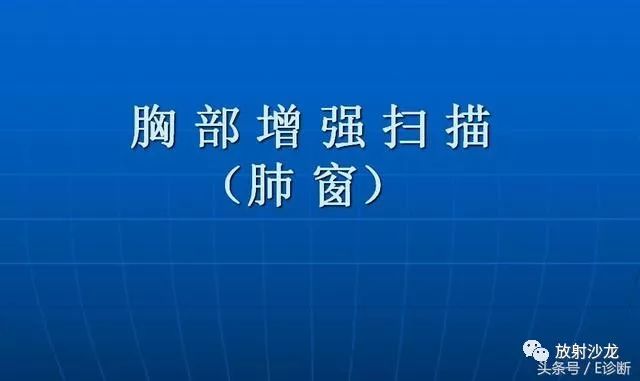 【病例】胸部孤立性纤维瘤1例CT影像表现