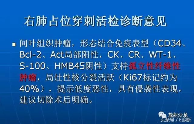 【病例】胸部孤立性纤维瘤1例CT影像表现
