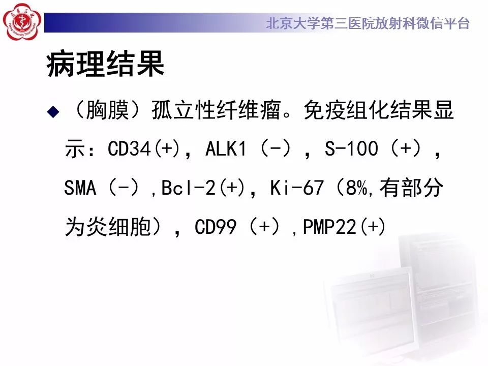 【病例】胸膜孤立性纤维瘤1例CT影像诊断