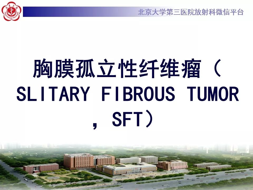 【病例】胸膜孤立性纤维瘤1例CT影像诊断