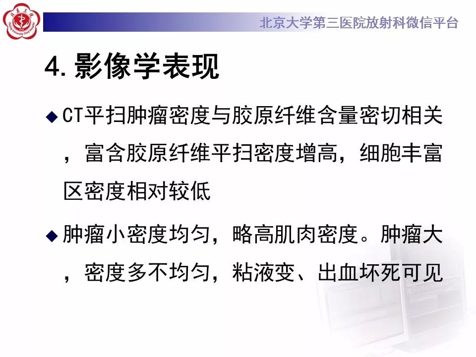 【病例】胸膜孤立性纤维瘤1例CT影像诊断