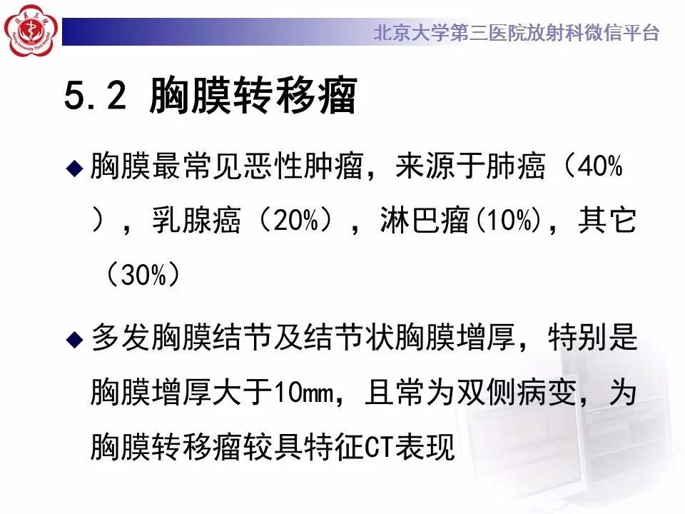 【病例】胸膜孤立性纤维瘤1例CT影像诊断