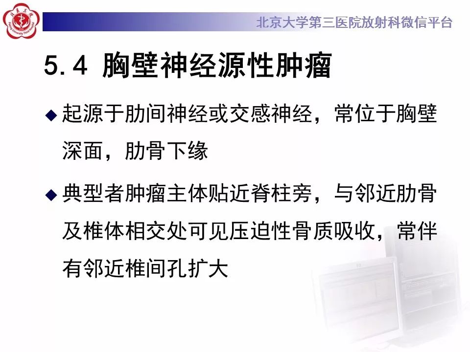 【病例】胸膜孤立性纤维瘤1例CT影像诊断