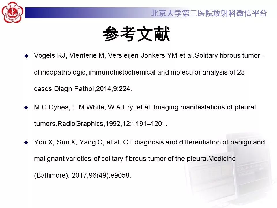【病例】胸膜孤立性纤维瘤1例CT影像诊断