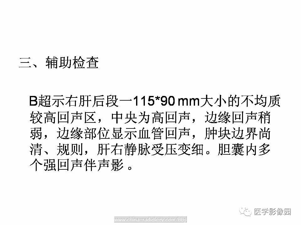 【病例】肝脏血管平滑肌脂肪瘤1例CT影像表现 【病例】肝脏血管平滑肌脂肪瘤1例CT影像表现