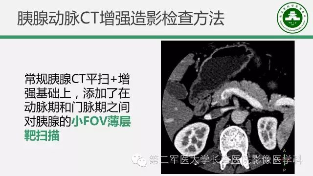 【PPT】胰腺动脉CT增强造影三维后处理与结构化报告书写