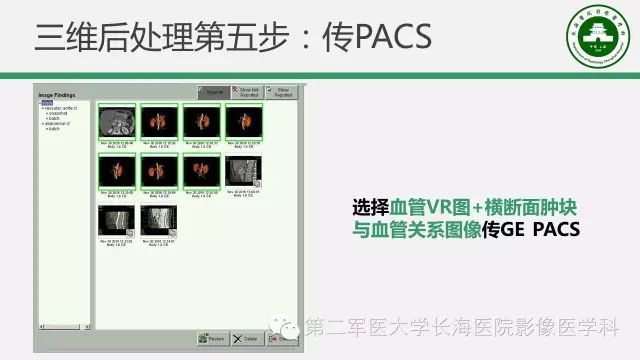 【PPT】胰腺动脉CT增强造影三维后处理与结构化报告书写