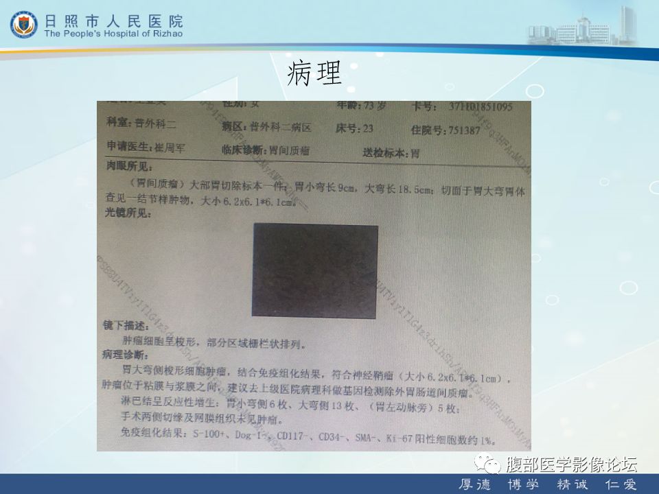 【病例】
