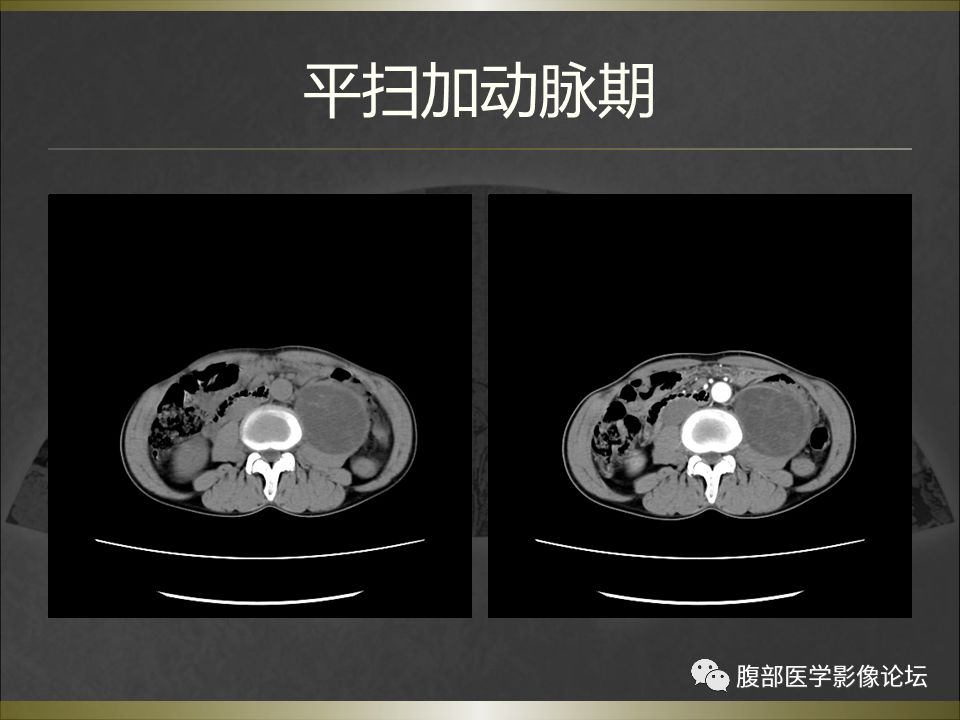 【病例】