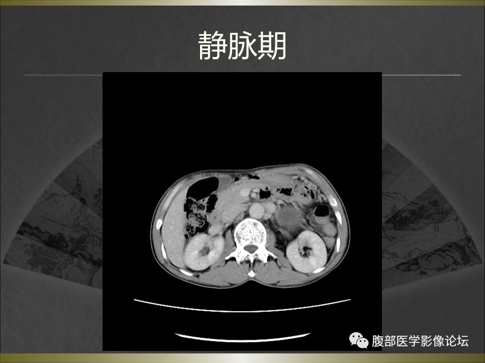 【病例】