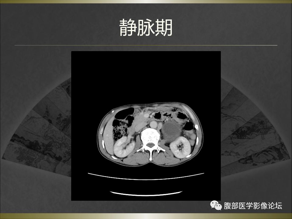 【病例】