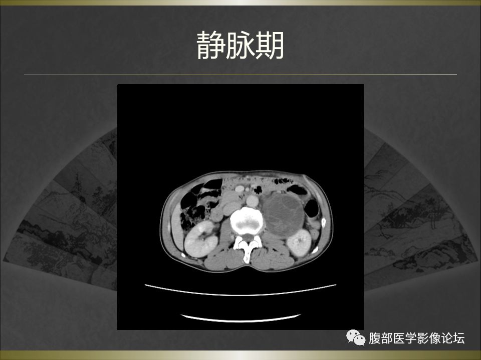 【病例】