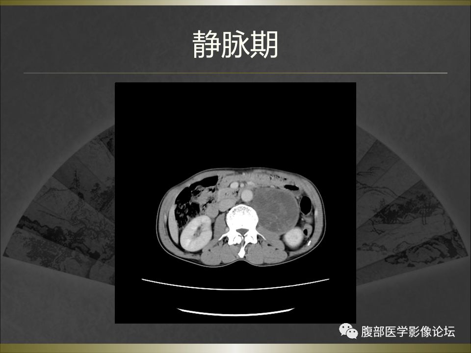 【病例】
