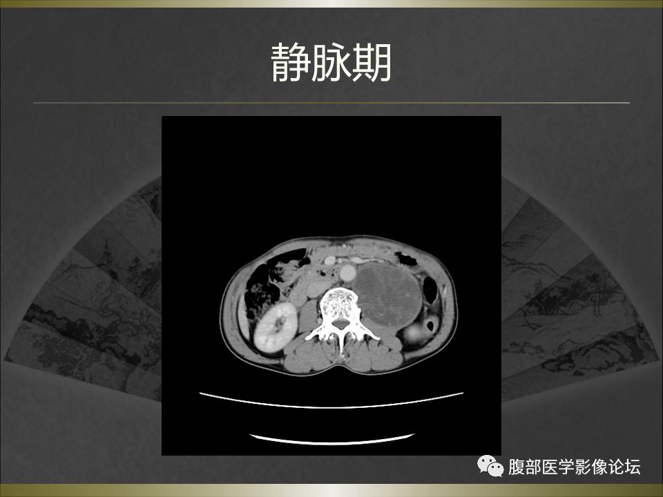 【病例】