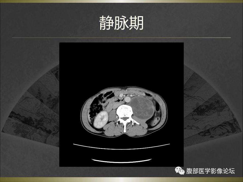 【病例】