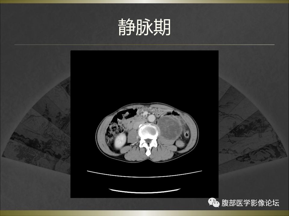 【病例】