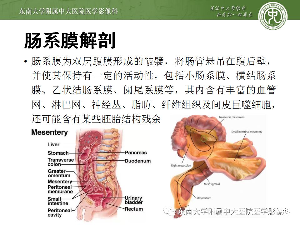 【病例】肠系膜脂膜炎1例CT影像诊断